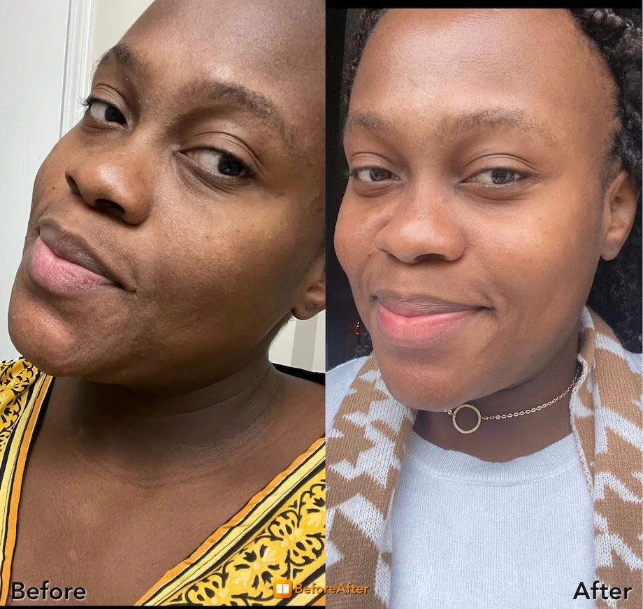 beforeandafter_460x@2x