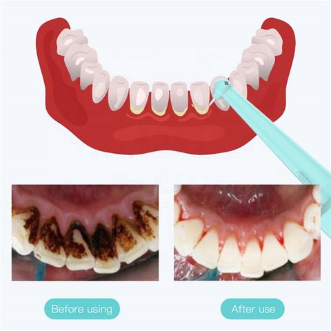 before_after_480x480